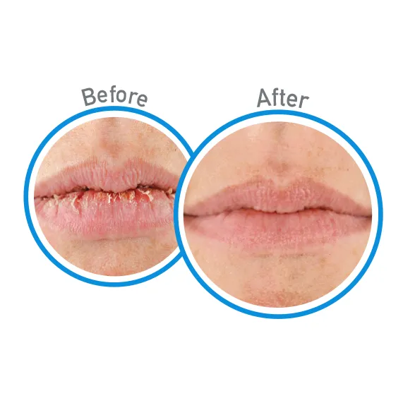 O'Keeffe's Lip Repair Lip Balm, Cooling Relief