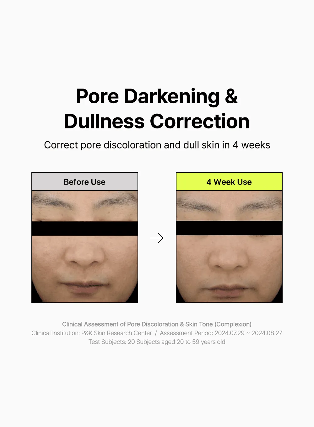 Pore Smoothing Bakuchiol Serum (30ml)